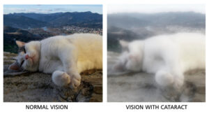 Normal Vision vs Vision with Cataract