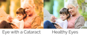 Eyes with a cataract vs healthy eyes